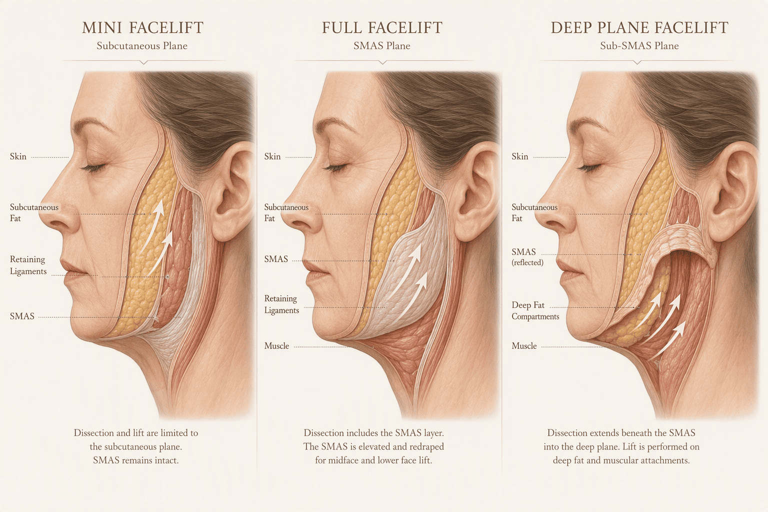 Illustration for Defining the Spectrum: Anatomical Depth and Tissue Manipulation